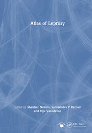 Atlas of Leprosy book cover