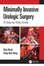 Minimally Invasive Urologic Surgery: A Step-by-Step Guide book cover