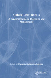Clinical Melioidosis: A Practical Guide to Diagnosis and Management book cover