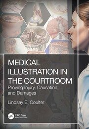 Medical Illustration in the Courtroom: Proving Injury, Causation, and Damages book cover
