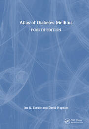 Atlas of Diabetes Mellitus book cover