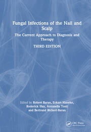 Fungal Infections of the Nail and Scalp: The Current Approach to Diagnosis and Therapy book cover