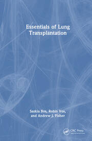 Essentials of Lung Transplantation book cover