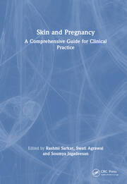 Skin and Pregnancy: A Comprehensive Guide for Clinical Practice book cover