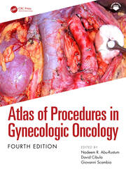 Atlas of Procedures in Gynecologic Oncology book cover