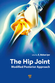 The Hip Joint: Modified Posterior Approach book cover