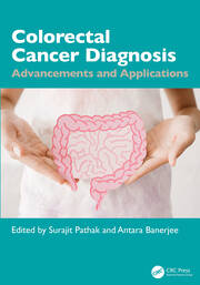Colorectal Cancer Diagnosis: Advancements and Applications book cover