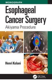 Esophageal Cancer Surgery: Akiyama Procedure book cover