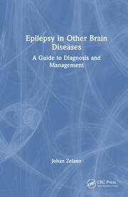 Epilepsy in Other Brain Diseases: A Guide to Diagnosis and Management book cover