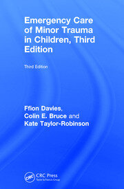Emergency Care of Minor Trauma in Children book cover