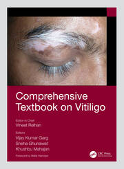 Comprehensive Textbook on Vitiligo book cover