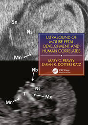 Ultrasound of Mouse Fetal Development and Human Correlates book cover