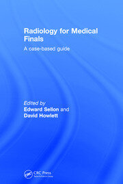 Radiology for Medical Finals: A case-based guide book cover