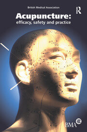 Acupuncture: Efficacy, Safety and Practice book cover