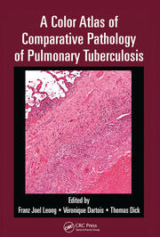 A Color Atlas of Comparative Pathology of Pulmonary Tuberculosis book cover