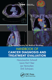 ESMO Handbook of Cancer Diagnosis and Treatment Evaluation book cover