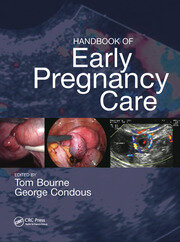 Handbook of Early Pregnancy Care book cover