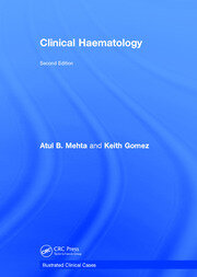Clinical Haematology: Illustrated Clinical Cases book cover