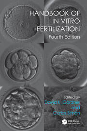 Handbook of In Vitro Fertilization book cover