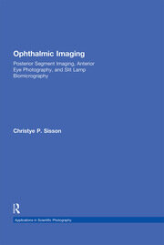 Ophthalmic Imaging: Posterior Segment Imaging, Anterior Eye Photography, and Slit Lamp Biomicrography book cover