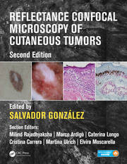 Reflectance Confocal Microscopy of Cutaneous Tumors book cover