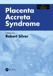 Placenta Accreta Syndrome book cover