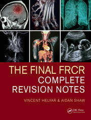 The Final FRCR: Complete Revision Notes book cover