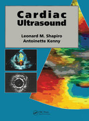 Cardiac Ultrasound book cover
