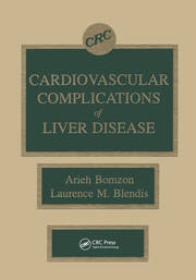 Cardiovascular Complications of Liver Disease book cover