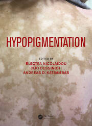 Hypopigmentation book cover