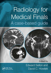 Radiology for Medical Finals: A case-based guide book cover