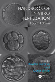 Handbook of In Vitro Fertilization book cover