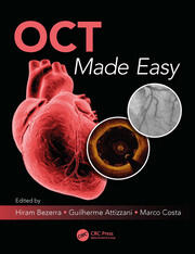 OCT Made Easy book cover