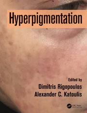 Hyperpigmentation book cover