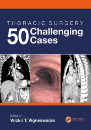Thoracic Surgery: 50 Challenging cases book cover