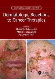 Dermatologic Reactions to Cancer Therapies book cover