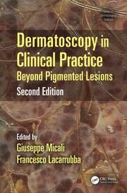 Dermatoscopy in Clinical Practice: Beyond Pigmented Lesions book cover