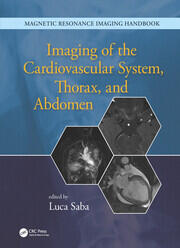 Imaging of the Cardiovascular System, Thorax, and Abdomen book cover