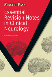 Essential Revision Notes in Clinical Neurology book cover