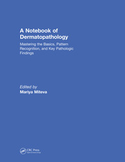 A Notebook of  Dermatopathology: Mastering the Basics, Pattern Recognition, and Key Pathologic Findings book cover