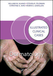 Dermatology: Illustrated Clinical Cases book cover