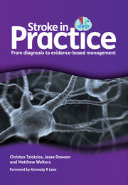 Stroke in Practice: From Diagnosis to Evidence-Based Management book cover