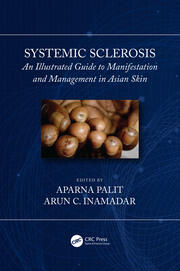 Systemic Sclerosis: An Illustrated Guide to Manifestation and Management in Asian Skin book cover