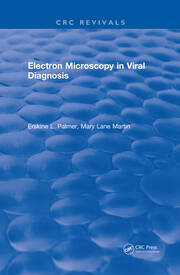 Electron Microscopy in Viral Diagnosis book cover