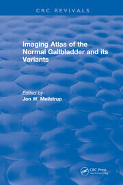 Imaging Atlas of the Normal Gallbladder and Its Variants book cover