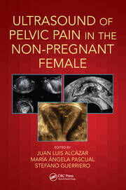 Ultrasound of Pelvic Pain in the Non-Pregnant Patient book cover