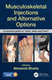 Musculoskeletal Injections and Alternative Options: A practical guide to 'what, when and how?' book cover