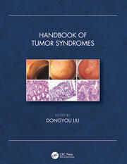 Handbook of Tumor Syndromes book cover
