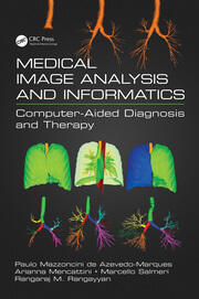 Medical Image Analysis and Informatics: Computer-Aided Diagnosis and Therapy book cover