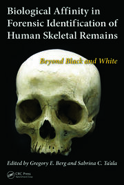 Biological Affinity in Forensic Identification of Human Skeletal Remains: Beyond Black and White book cover